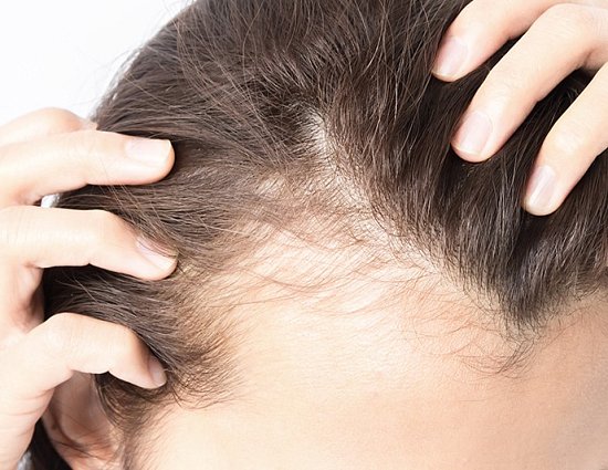 Как предотвратить выпадение волос?